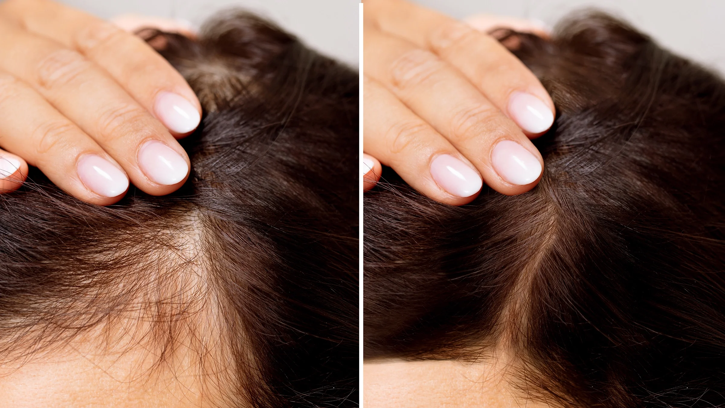 Hair Treatment